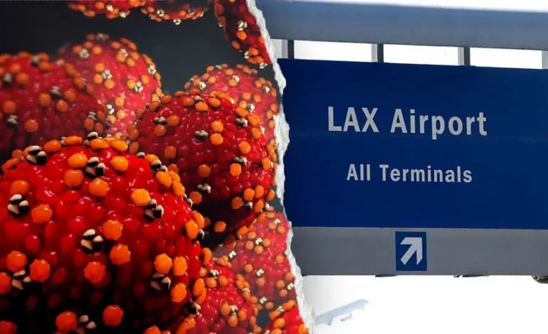 Measles Exposure Alert: LAX, Nearby Hotel Potential Contamination