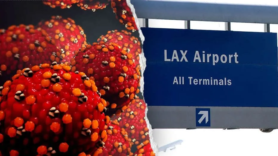 Measles Exposure Alert: LAX, Nearby Hotel Potential Contamination
