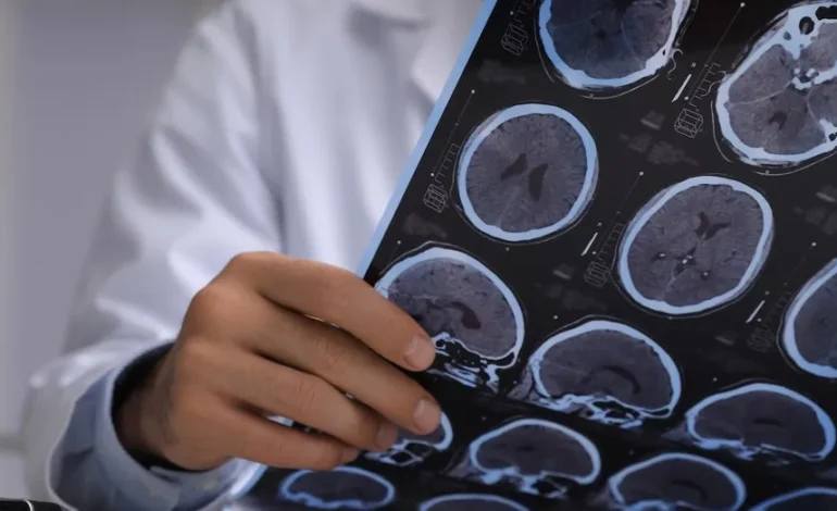 Brain Cancer Scare Reveals Live Tapeworms in Man’s Head
