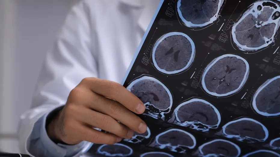 Brain Cancer Scare Reveals Live Tapeworms in Man’s Head